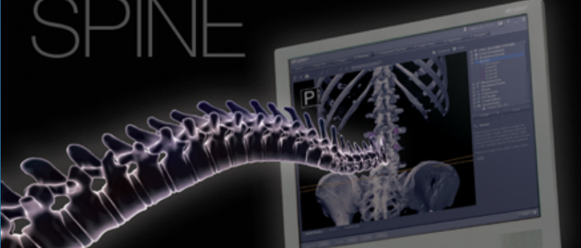 simposio internacional de cirugía vertebral con navegacion intraoperatoria en 3D coruna