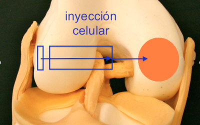 fig-7-inyección-celulas-cultivadas